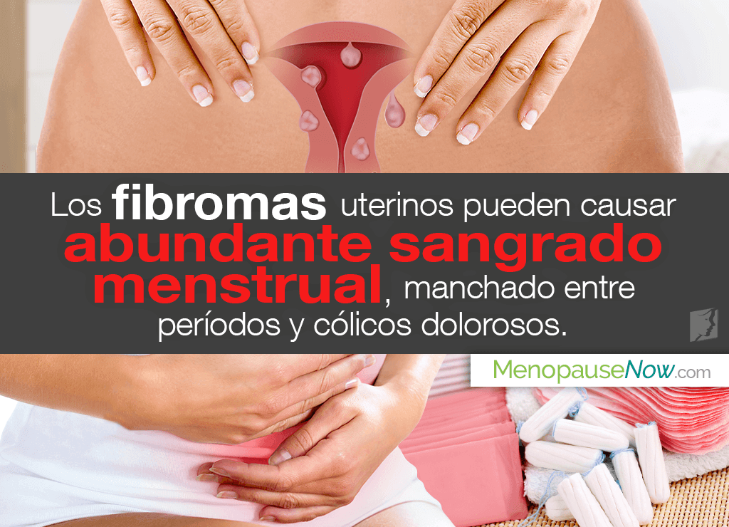 ¿Los fibromas uterinos causan menstruación irregular? Preguntas y respuestas