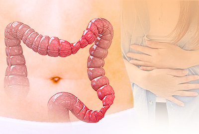 Severe Bloating: Important Things to Know
