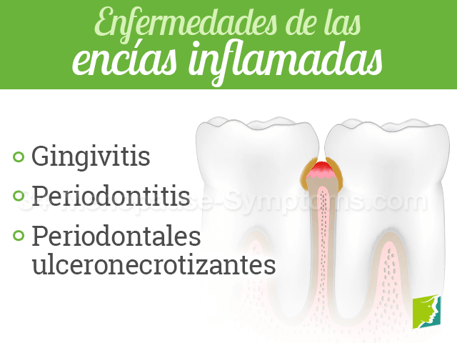 Enfermedades de las encías inflamadas