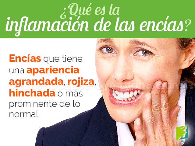 ¿Qué es la inflamación de las encías?