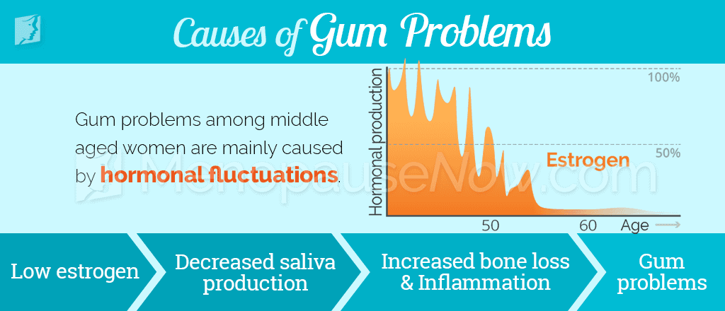 Causes of gum problems