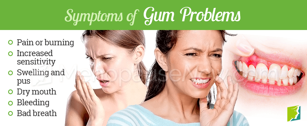Symptoms of gum problems