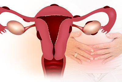 Endometriosis after Menopause