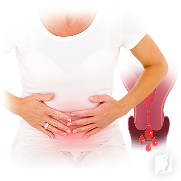symptoms of endometriosis after menopause