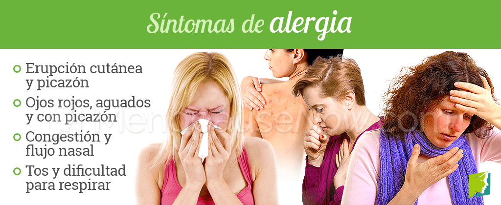 Síntomas de alergia