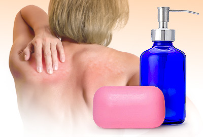 10 Common Reasons for Itchy Skin