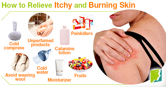 12 Tips to Relieve Itchy and Burning Skin