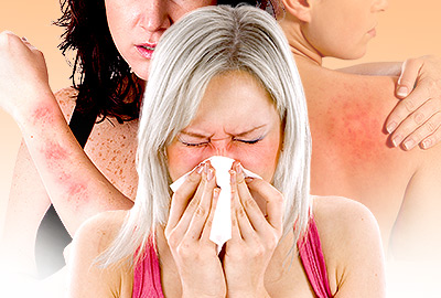 Todo sobre las alergias en la menopausia