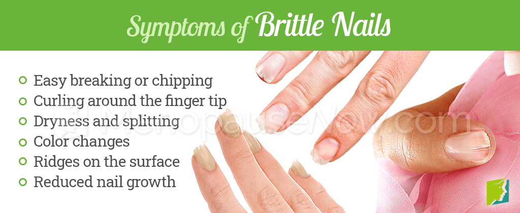 Brittle Nails Symptom Information | Menopause Now