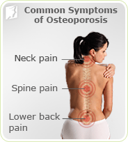 Common Symptoms of Osteoporosis