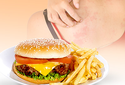 6 hábitos que causan picazón en el cuello