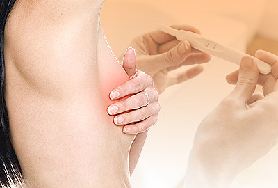 ¿Puedo embarazarme si soy irregular?