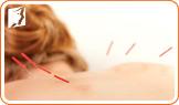 Acupuncture to Curb Your Menopausal Hot Flashes2