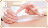 Acupuncture to Curb Your Menopausal Hot Flashes4
