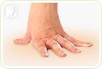 4 Exercises to Prevent Wrist Joint Pain at Your Desk Job