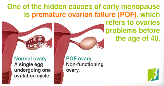 One of the hidden causes of early menopause is premature ovarian failure (POF)