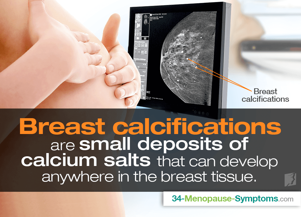 Breast calcifications