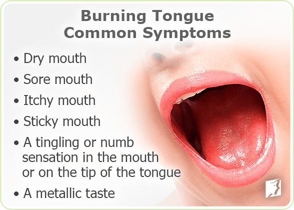 Burning tongue common symptoms