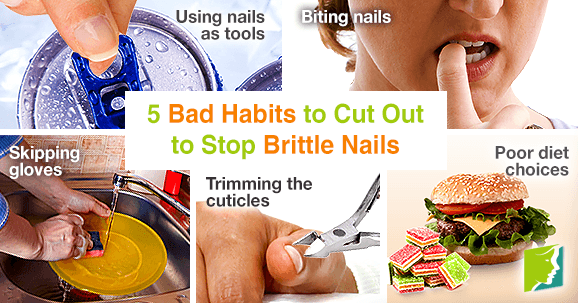 5 bad habits to cut out to stop brittle nails