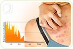 5 Common Causes of Itchy Skin in Menopausal Women