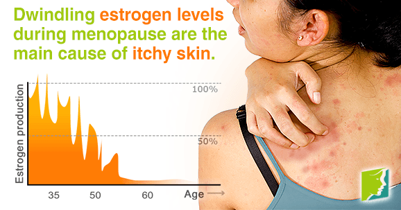 Dwindling estrogen levels during menopause are the main cause of itchy skin