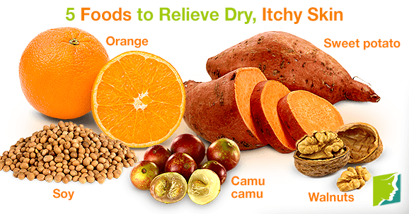 5 Foods to Relieve Dry, Itchy Skin
