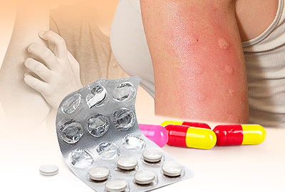 5 Hidden Conditions That Could Be Behind Itchy Skin