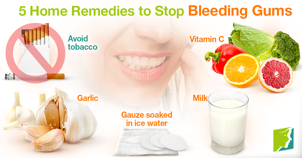 What Causes Bleeding Gums? + 5 Easy Natural Remedies ile ilgili görsel sonucu