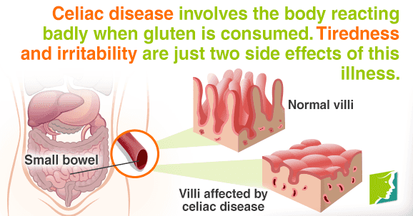 Fatigue is a side effect of celiac disease