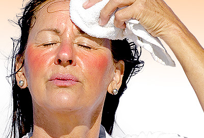 Severe Hot Flashes: Important Things to Know
