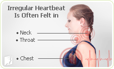 Irregular heartbeat