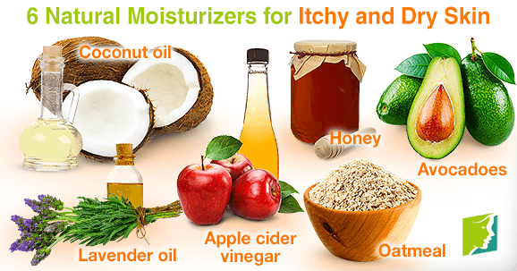 6 natural moisturizers for itchy and dry skin