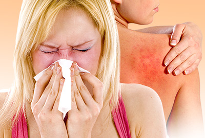7 Common Symptoms of Allergies during Menopause