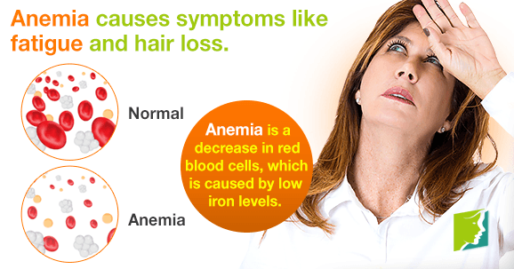 Anemia causes symptoms like fatigue and hair loss