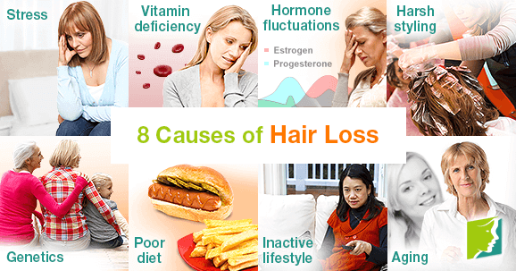 8 Causes of Hair Loss