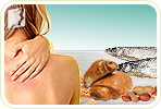 8 Common Food Allergies