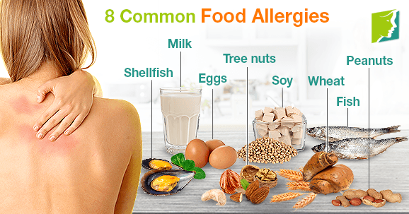 8 Common Food Allergies