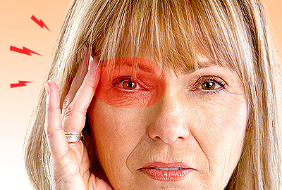 Cluster Headaches FAQs