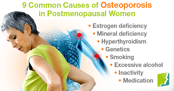 9 Common Causes Of Osteoporosis In Postmenopausal Women 