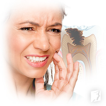 Tooth decay