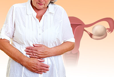 Quistes ováricos después de la menopausia