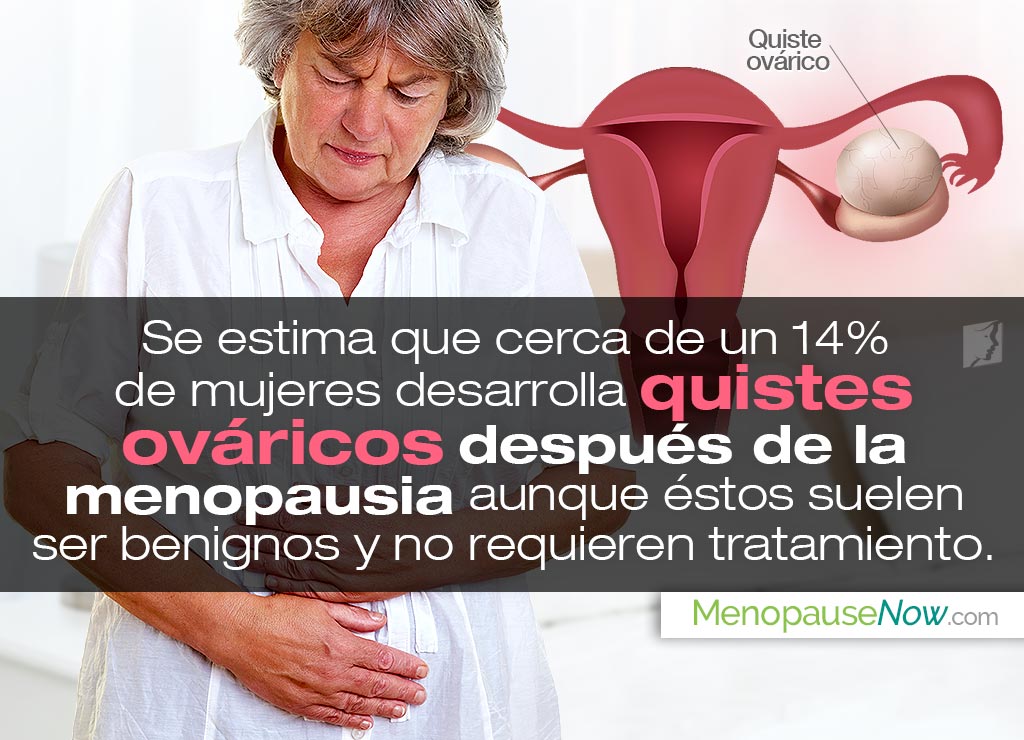 Quistes ováricos después de la menopausia