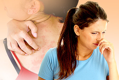 Types of Allergies