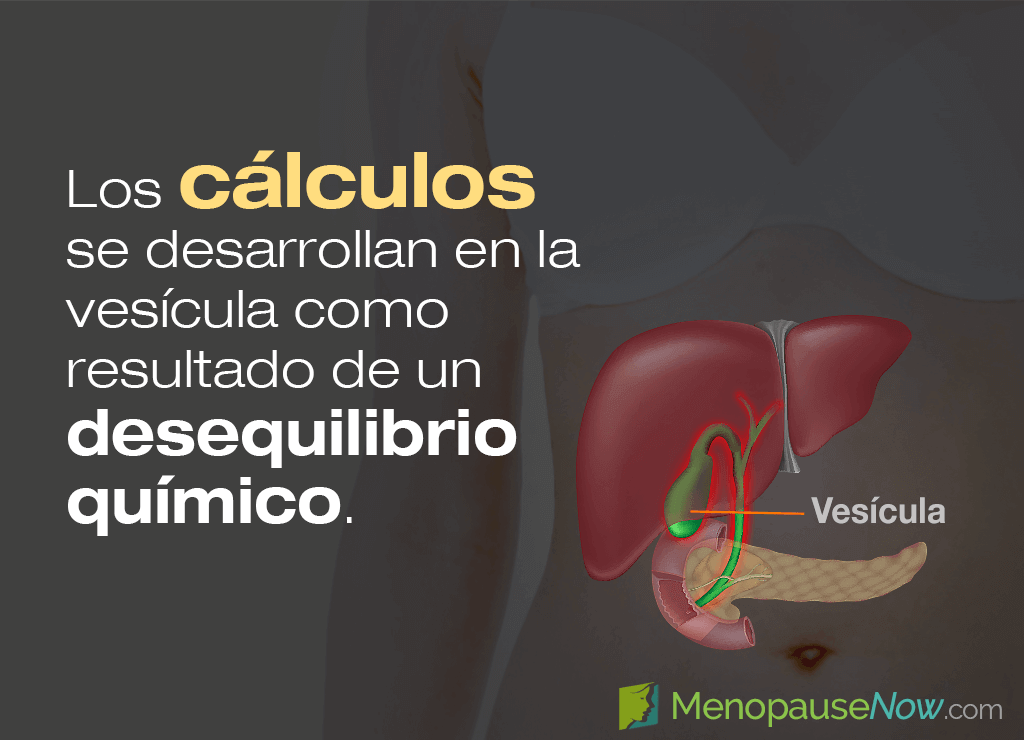Cálculos biliares y aumento de peso en la menopausia