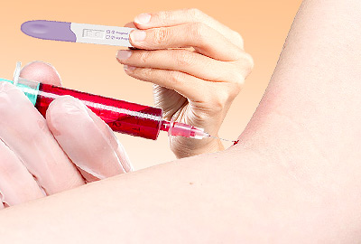 Tests for Irregular Periods: Blood, Hormones, and More