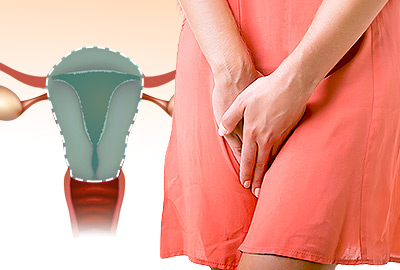 Sequedad vaginal después de una histerectomía