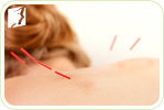Acupuncture to Treat Your Menopausal Loss of Libido