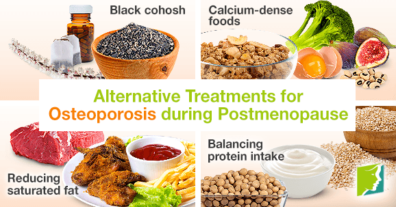 Alternative Treatments for Osteoporosis during Postmenopause