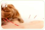 Alternative Treatments for Osteoporosis