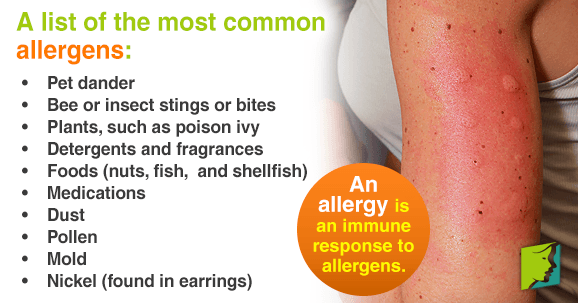 An Overview Of Allergies That Can Cause Itchy Skin Menopause Now